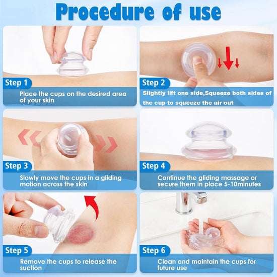 4 pieces silicone cups - Cupping cups - Cupping Set - Cellulite Cups - Cupping For Cellulite - vacuum cup - For reducing cellulite anti-aging relieves pain and joints for buttocks, neck, body - Green