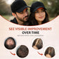 Laser Hair Growth Cap - 650nm Red Light Therapy for Hair Regrowth, Full Scalp Coverage Treatment for Men & Women with Thinning Hair, Portable & Hands-Free, Black