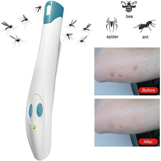 Portable Anti-Itch Pen for Bug Bites – Electronic Relief Device for Mosquito, Bee, Spider & Ant Stings, Chemical-Free Pain Relief, Instant Soothing (White)