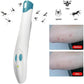 Portable Anti-Itch Pen for Bug Bites – Electronic Relief Device for Mosquito, Bee, Spider & Ant Stings, Chemical-Free Pain Relief, Instant Soothing (White)