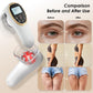 Modern Jingluo Beauty Massager – Electric Meridian Facial & Body Roller with Gentle Suction and Warmth, Multi-Speed Skincare Tool for Relaxing Rituals (White)