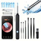 Wireless Ear Camera Cleaner Kit for Safe Ear Care