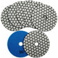 7 pcs Diamond Polishing Disc 4"/100Mm Dry Diamond Polishing Pads For Marble, Granite, Stone, Concrete (50)