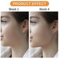 Jawline Exerciser, Jaw Exerciser For Men And Women, Jaw Trainer