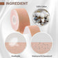 Face Tape For Castor Oil, Face Tape For Castor Oil Effective, For Face