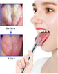 3PCS Practical Stainless Tongue Scrapers, Metal Tongue Cleaner for Oral Hygiene