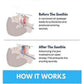 Honex Anti-Snoring Mouthpiece - Quite Night Device, PC+EVA