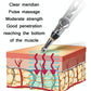 Electronic Acupuncture Pen 3 Head Circulating Energy Automatic Point Finding Home Pain Relief