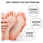 Black Electric Foot Callus Remover - Portable Pedicure Tool for Smooth Feet