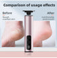 Rose Gold Professional 2-in-1 Electric Foot Callus Remover and Manicure Kit - 9 Speeds Rechargeable Electronic Foot File with LCD Display - Professional Pedicure Tool for Dead Skin and Nail Care