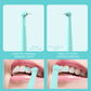 Intelligent High-Frequency Vibration Dental Calculus & Stain Remover(pink)