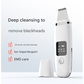White Professional 4-in-1 Ultrasonic Skin Scrubber - Deep Pore Cleanser, Blackhead Remover & EMS Facial Lifting Tool