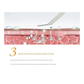 Green Professional Ultrasonic Skin Scrubber - 4-in-1 Facial Spatula for Deep Cleaning, Blackhead Removal, and EMS Lifting