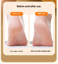 Electric Foot Callus Remover Rechargeable Pedicure Tool with 3 Grinding Heads Portable Dead Skin Exfoliator Ivory White