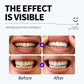 Professional Enamel-Safe Teeth Whitening Strips(12 Strips per Pack) - Antibacterial Gum Care & Deep Cleaning