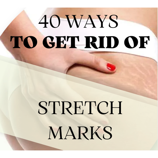 Stretch Marks Be Gone: 40 Proven Ways to Prevent and Treat Stretch Marks - eBook - Instant Download